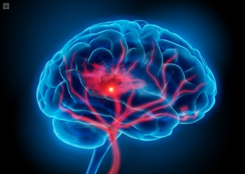 Daños neurológicos, grave secuela de Covid-19: expertos